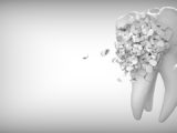 Was tun gegen Schmerzen durch einen gebrochenen Zahn?