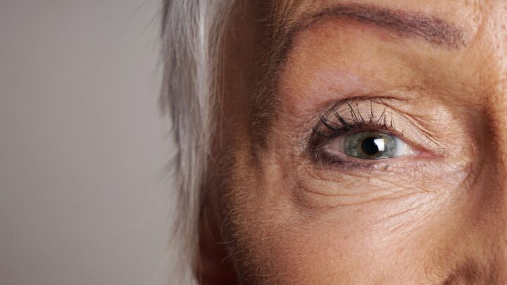 Botox-Injektionen sind die beste Behandlung für Falten und feine Linien