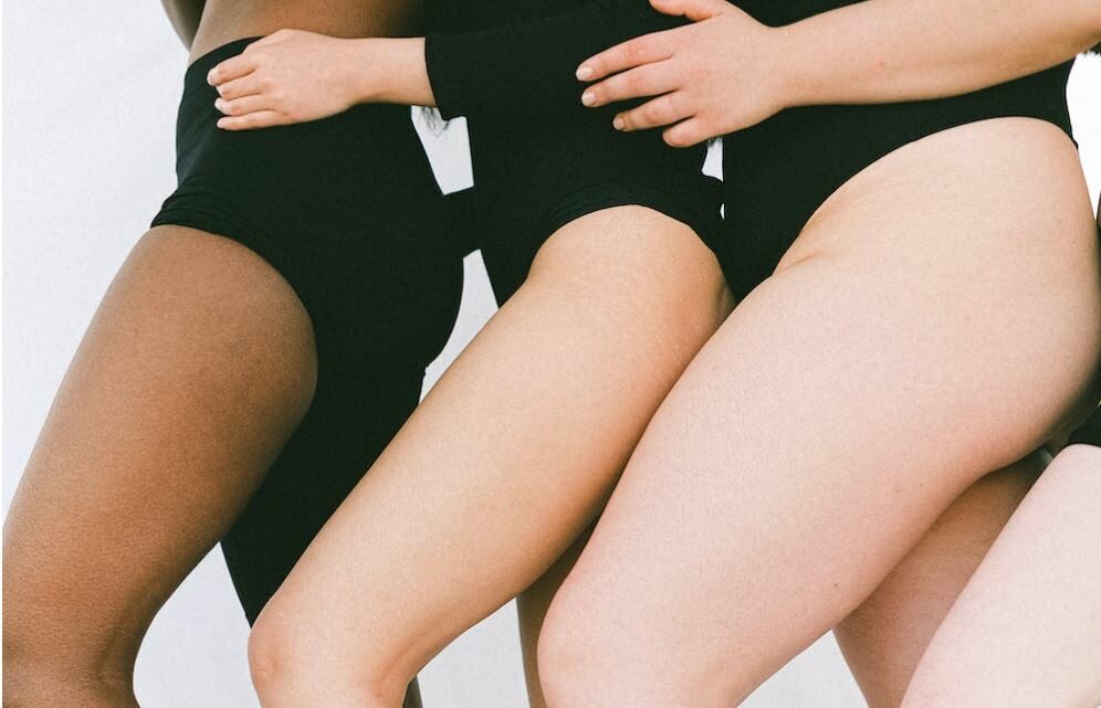 Was ist die Behandlung von Lipödemen? Was ist die Behandlung von Lipödemen?
